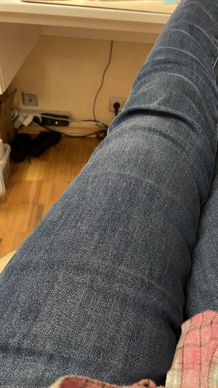 Нога, которая не танцует